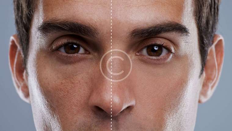 Male Skin Care Treatments